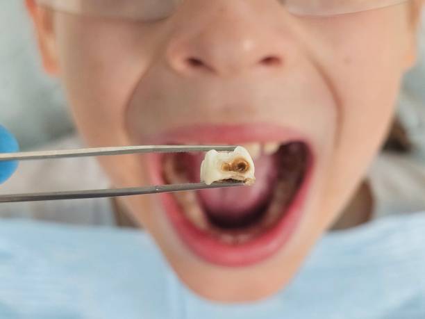 Best Mobile Emergency Dentist in Creve Coeur, IL