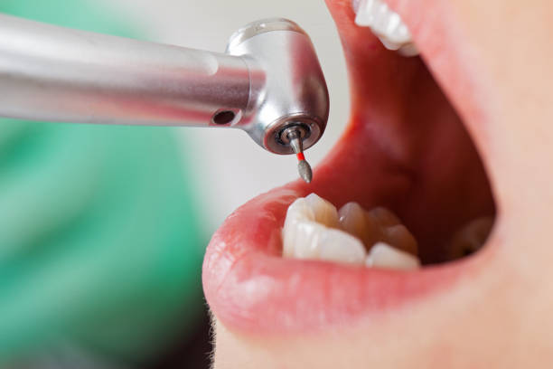 Best Emergency Dentist for Knocked-Out Tooth in Creve Coeur, IL